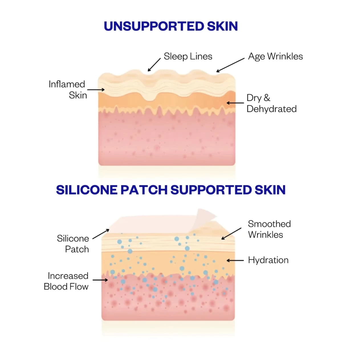 Wrinkles Schminkles Mouth & Lip Wrinkle Patch - 2 Pack 4 Wrinkles Schminkles Mouth & Lip Wrinkle Patch - 2 Pack - Image 4